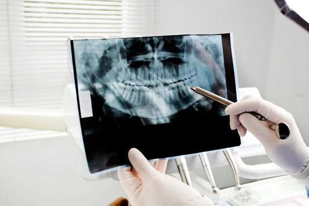 Dentist examining dental X-ray in clinical office setting with gloved hands.