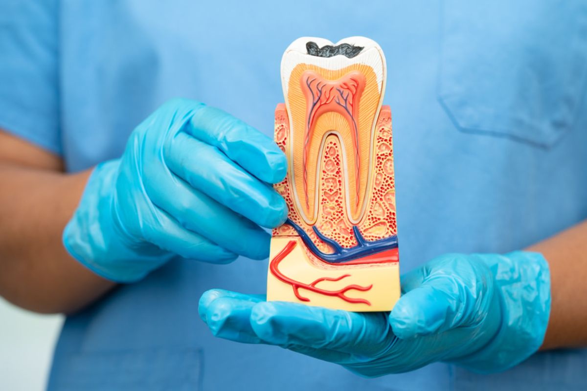root canal therapy in Germantown