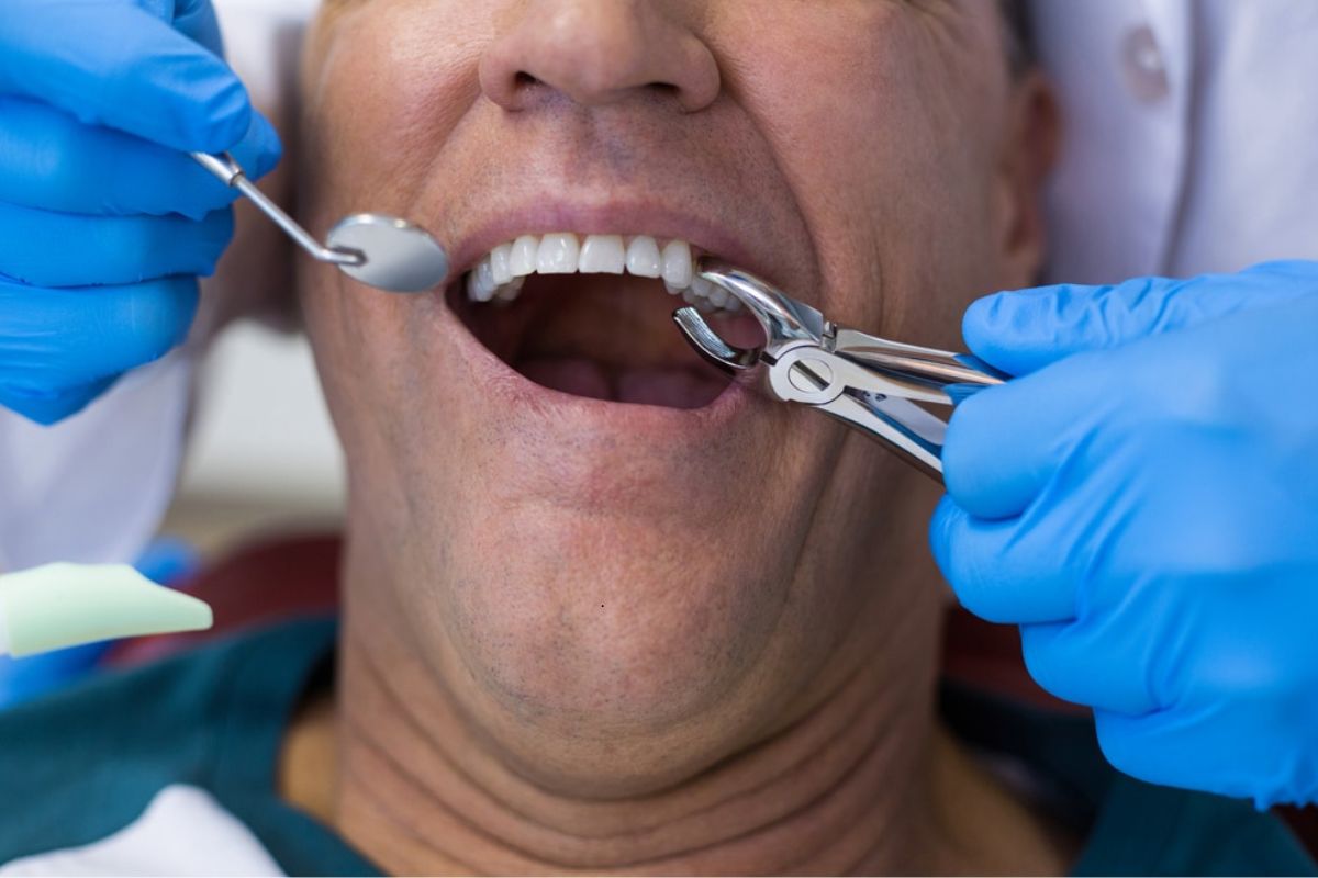 tooth extractions germantown
