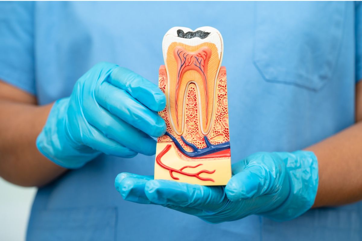 root canal therapy silver spring