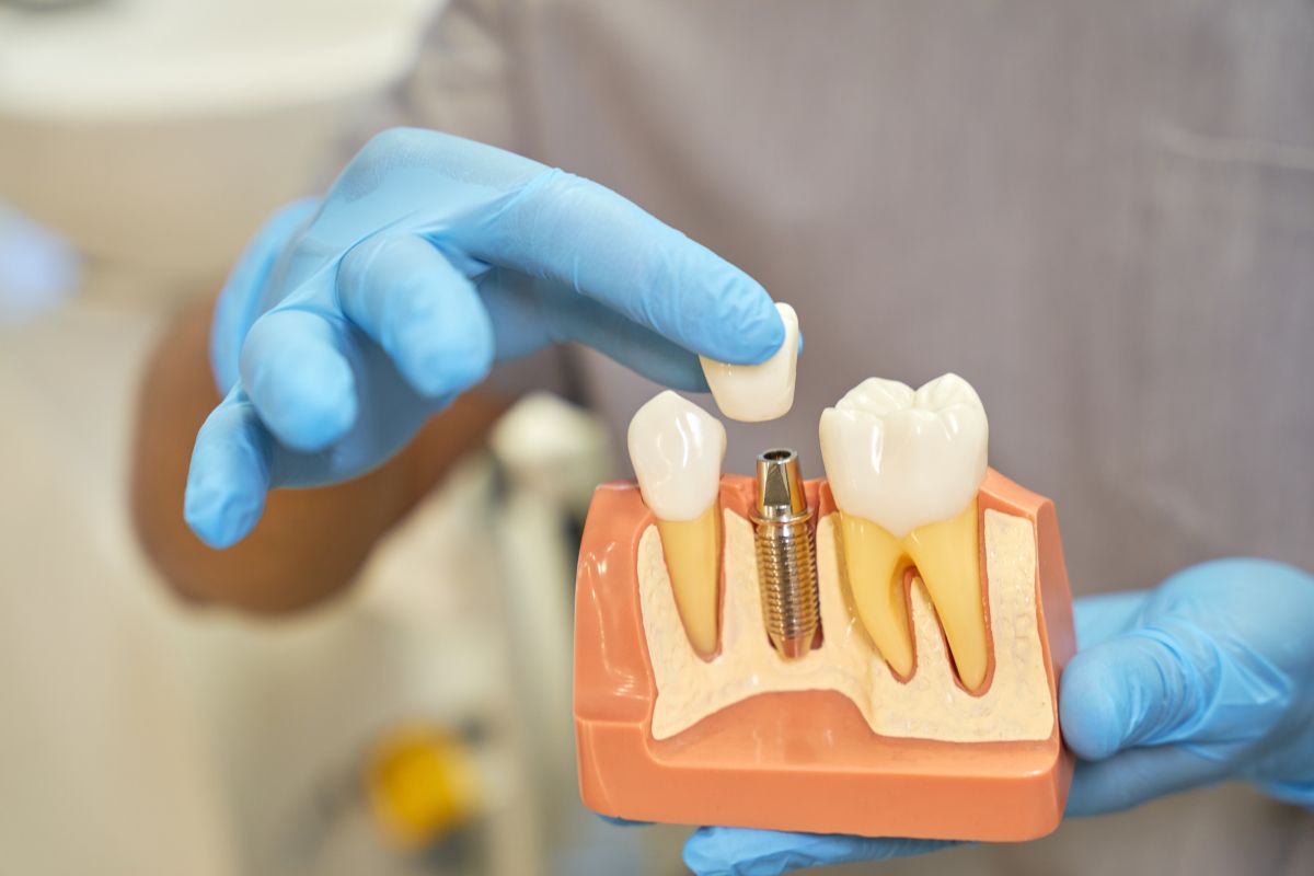 regular checkups for dental implants in Silver Spring