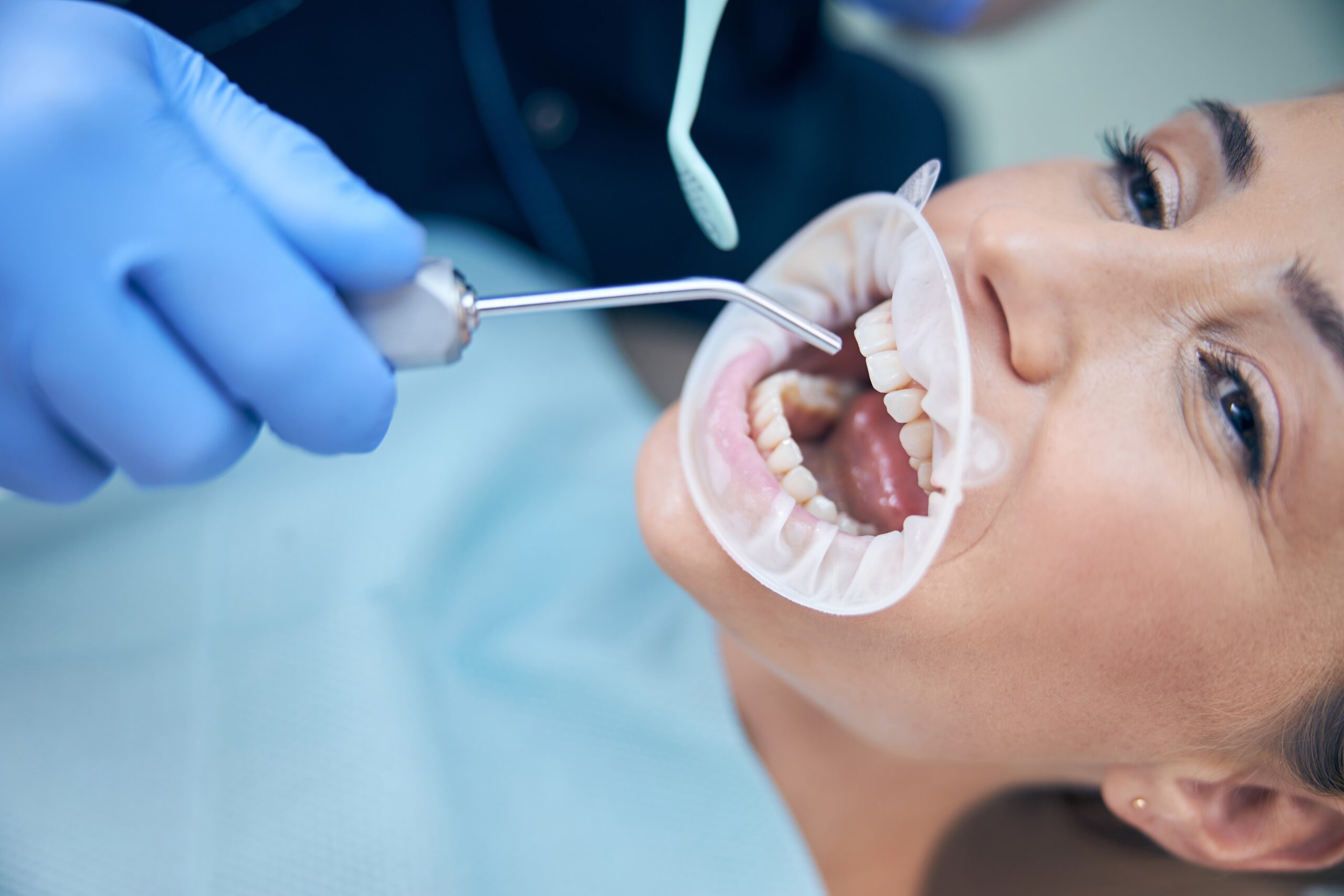 Gum Disease treatment in Silver Spring, Maryland